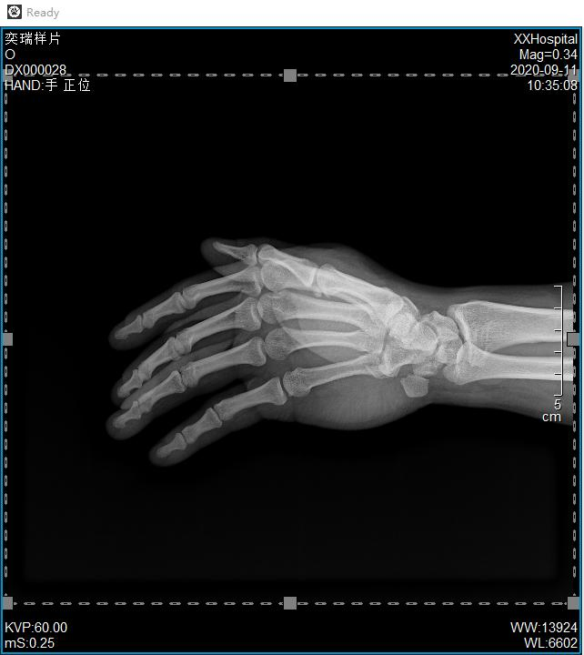 Careray Medical Mammography Diagnostic Portable 17"17" Wireless Dr X Ray Flat Panel Detector