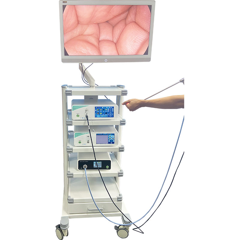 UHD Endoscopy Camera System with Light Source, Monitor and Endo Trolley