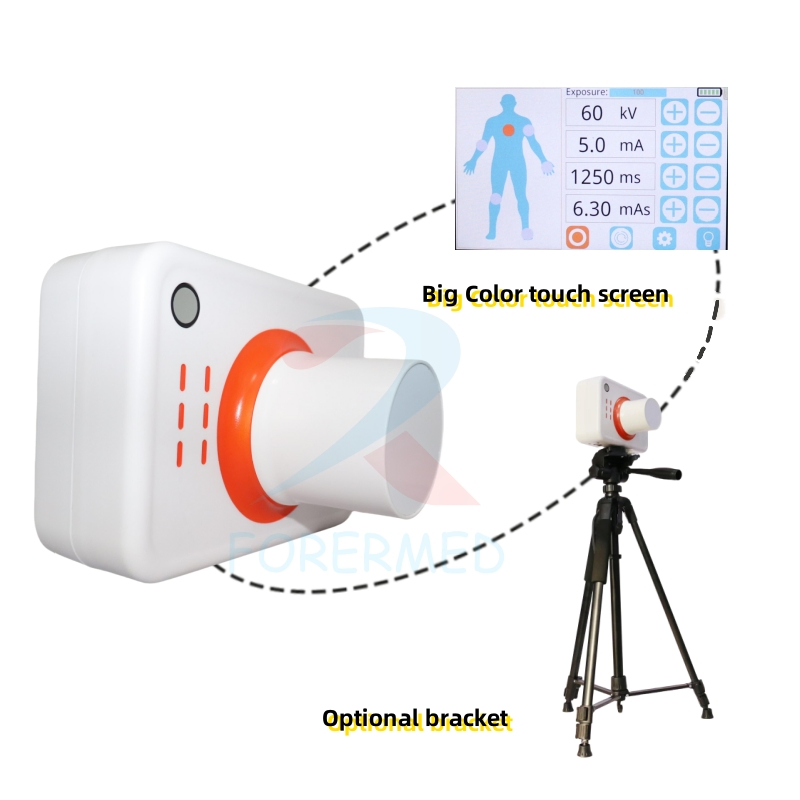 Portable X Ray Device Digital Imaging Dr System Superb Image Quality 70kv Handheld X-ray Device