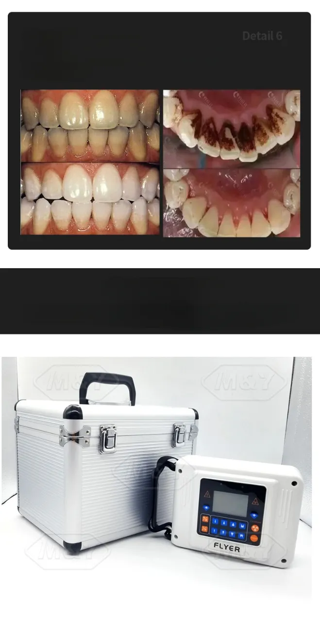 Dental X-ray Equipment 6