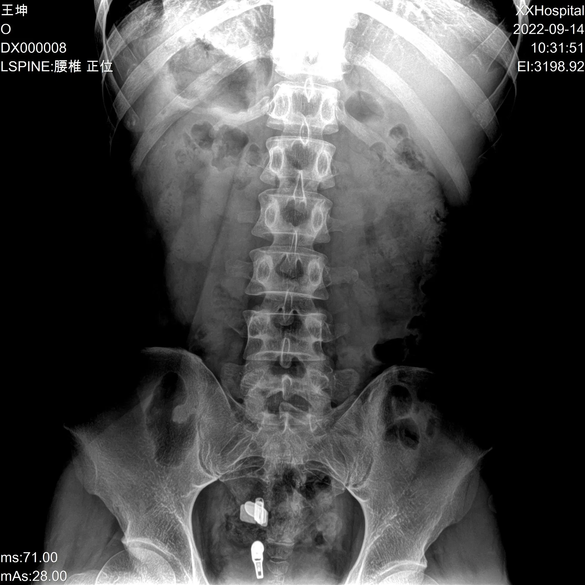 Digital X-ray Radiography System Dr with Affordable Cost