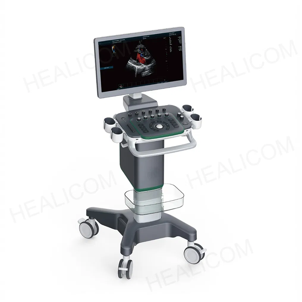 High Resolution All Digital Color Doppler System 4D Real-Time Imaging Medical Ultrasound Scanner with Dual Screen