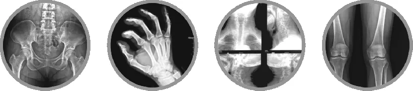 Digital Radiography System