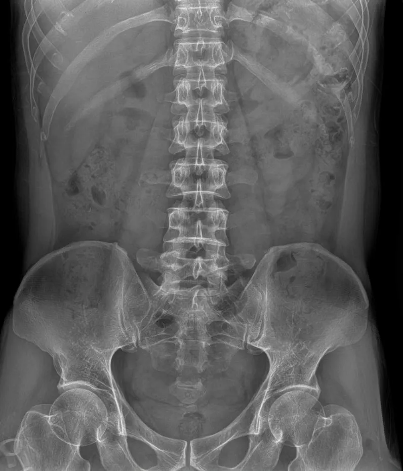 X-ray Image 3
