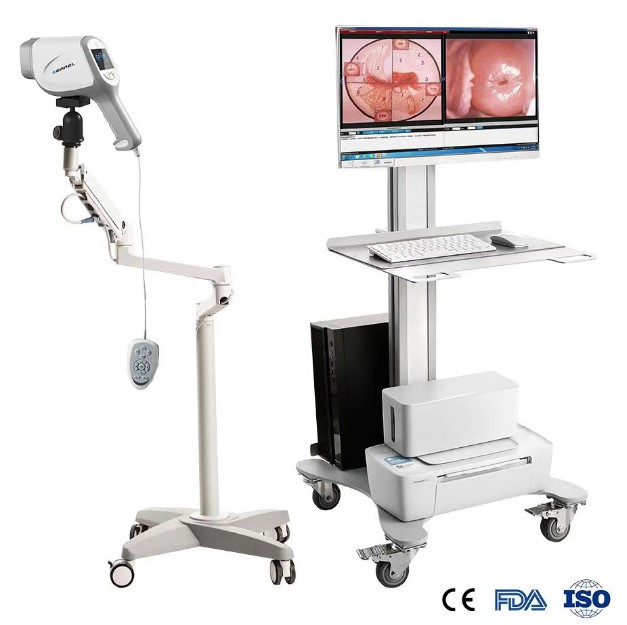 High-Resolution Colposcope Imaging System kN-2200A for Medical Use