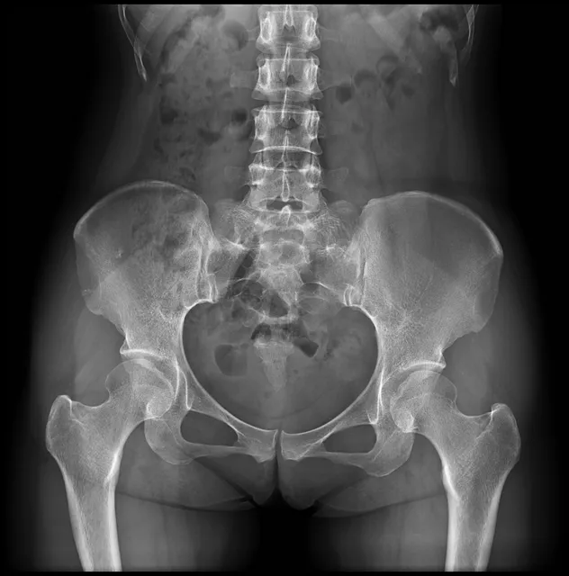 DR System Component 1