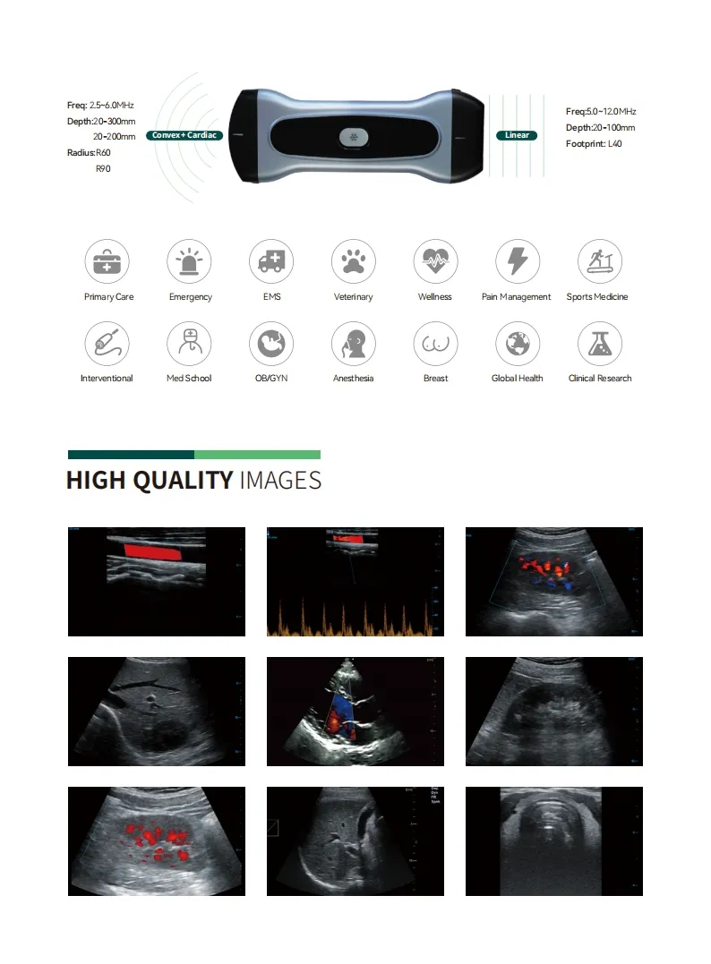 Ultrasound Imaging 3