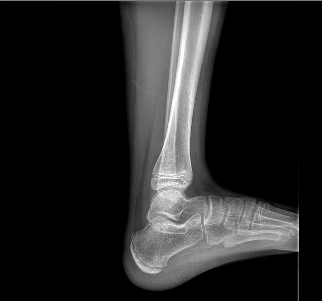 X-ray Image Sample 2