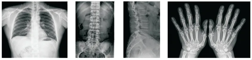 U-Arm Dr Digital Radiography System