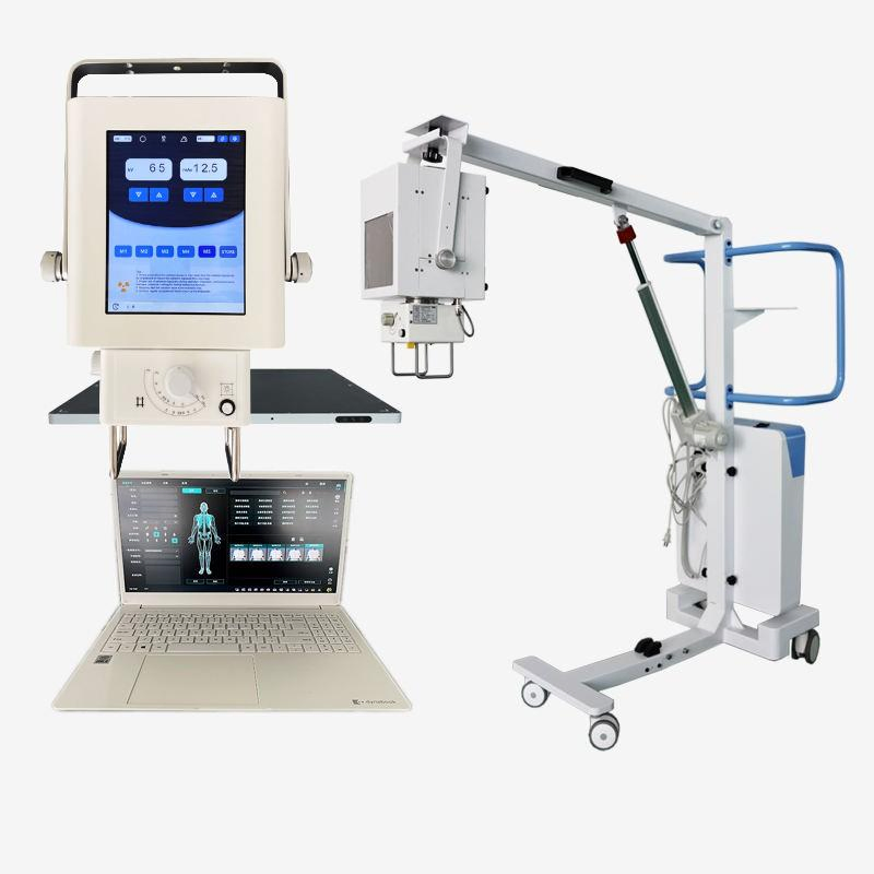 High-Precision Medical X-ray Equipment for Patient Care Solutions