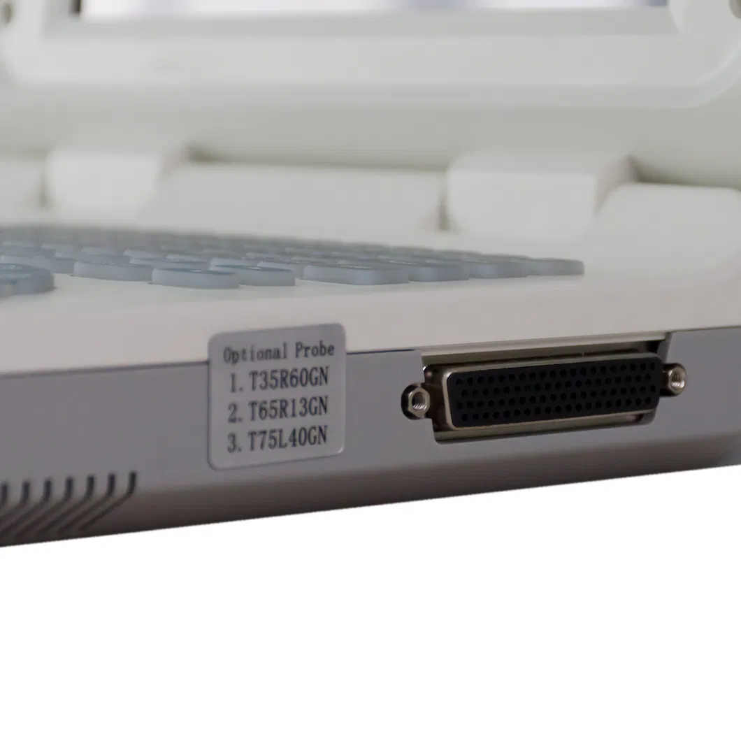 U20 Ultrasound System View 2