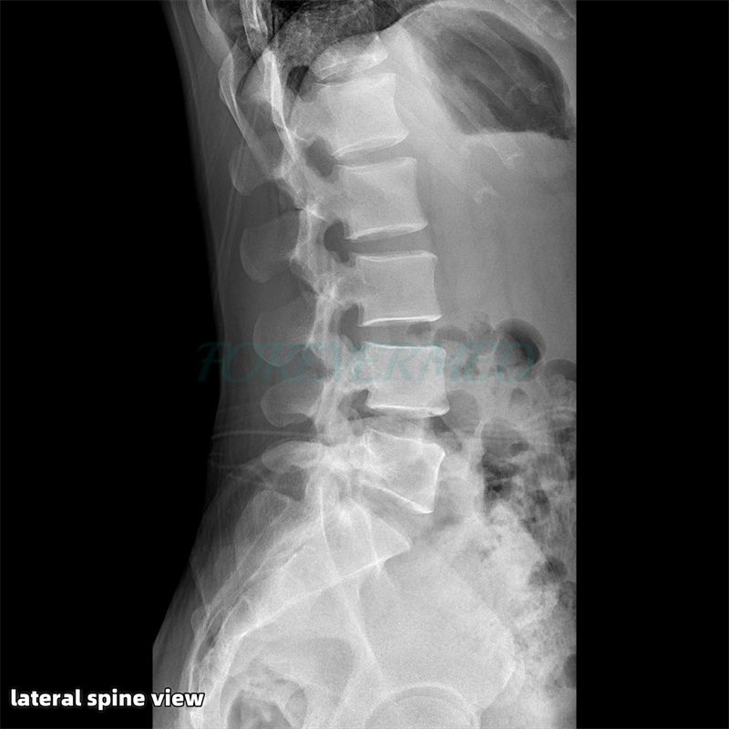 Advanced Dynamic Digital Radiography and Fluoroscopy Imaging System