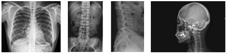 X-Ray Imaging Components