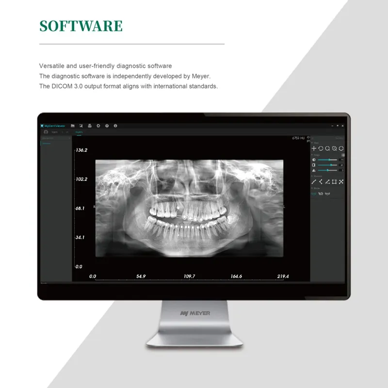 Dental X-Ray Detail 5