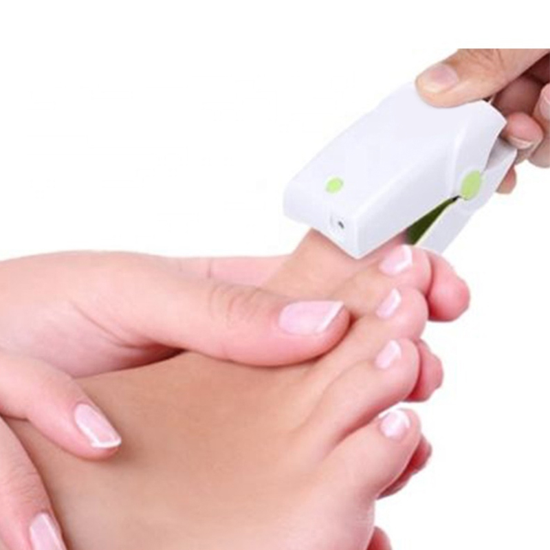 Cold Laser Treatment of Fungal Nail Disease 905nm Laser with 465nm Blue Light, Welcome OEM Order