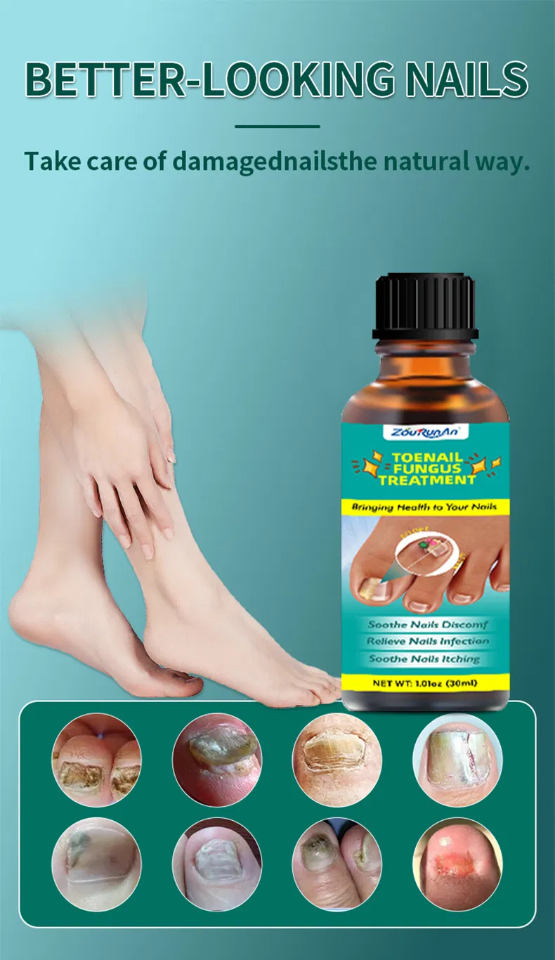 Before and After Nail Fungus Treatment Progression