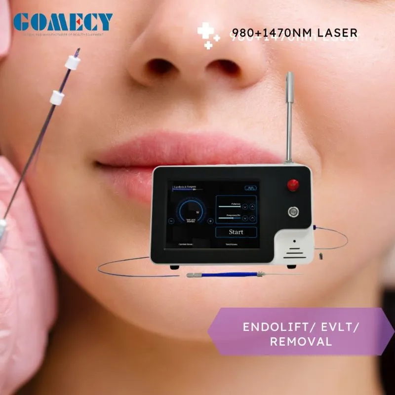 Laser Lipolysis