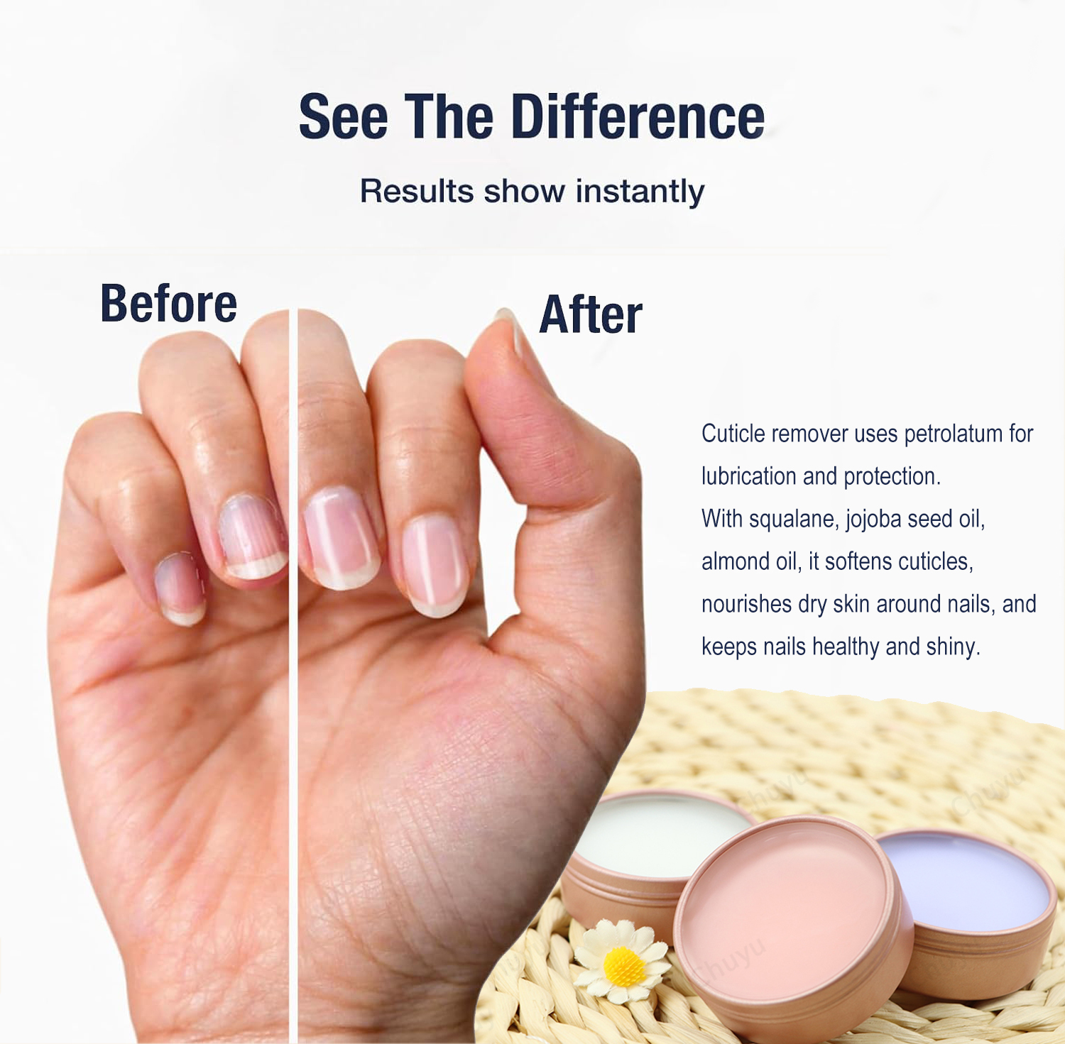 Vegan 4-in-1 Cuticle Balm Cuticle &amp; Nail Salve Oil to Moisturize &amp; Protect &amp; Heal Cracked &amp; Rigid Skin &amp; Cuticle Removal