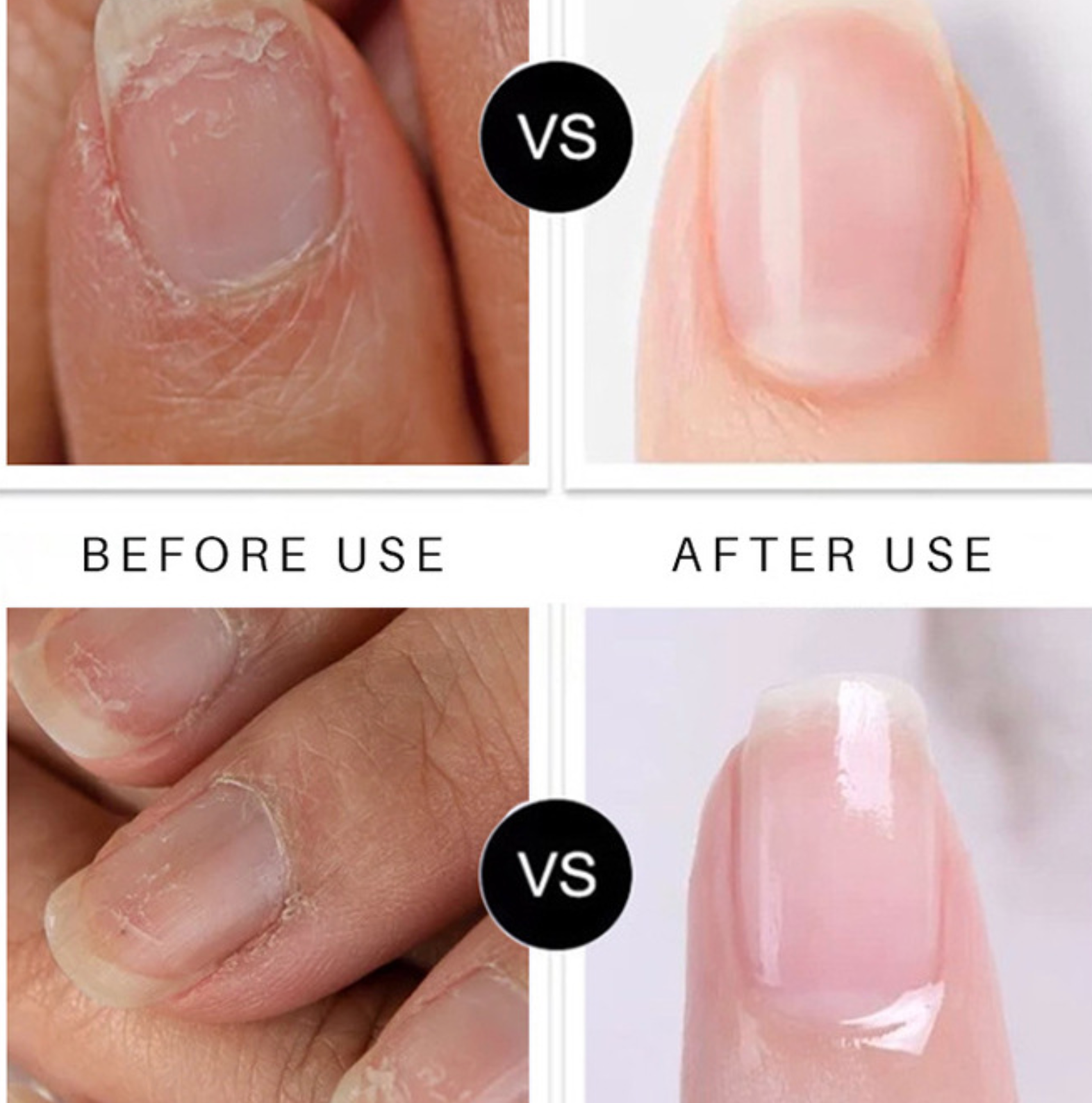 Wholesale Korean Nail Care Products Personal Nail Fungus Pen for Toenail &amp; Fingernail Treatment Cuticle Oil Repair Pen