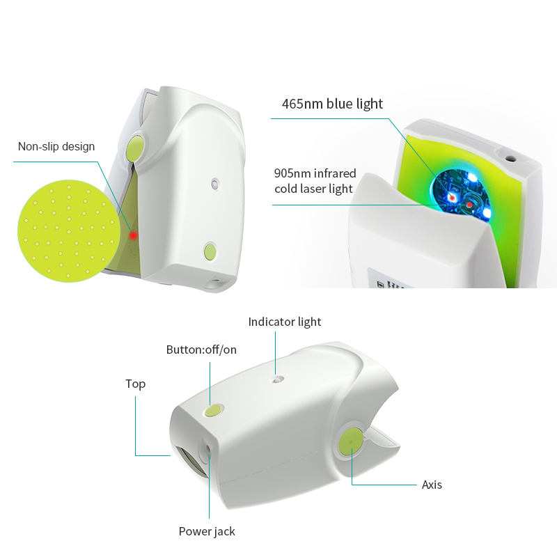 Cold Laser Treatment of Fungal Nail Disease 905nm Laser with 465nm Blue Light, Welcome OEM Order