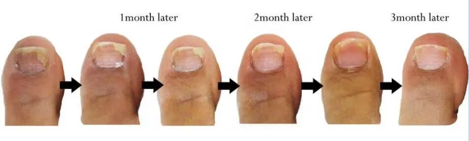 Before and After Effect 2