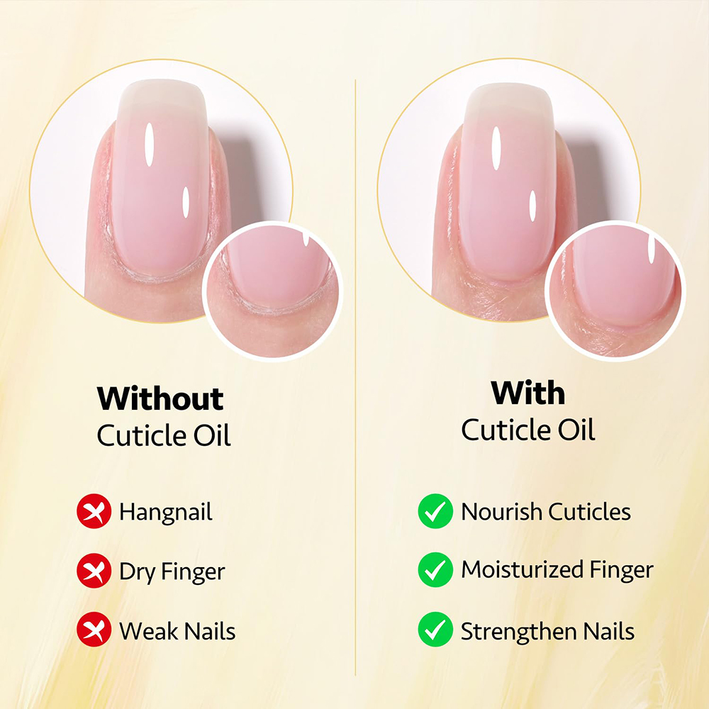 Custom Wholesale Organic Nail Care Products Nail &amp; Cuticle Moisturizing Soothing Repair Strengthen Growth Nail Oil Serum Dropper