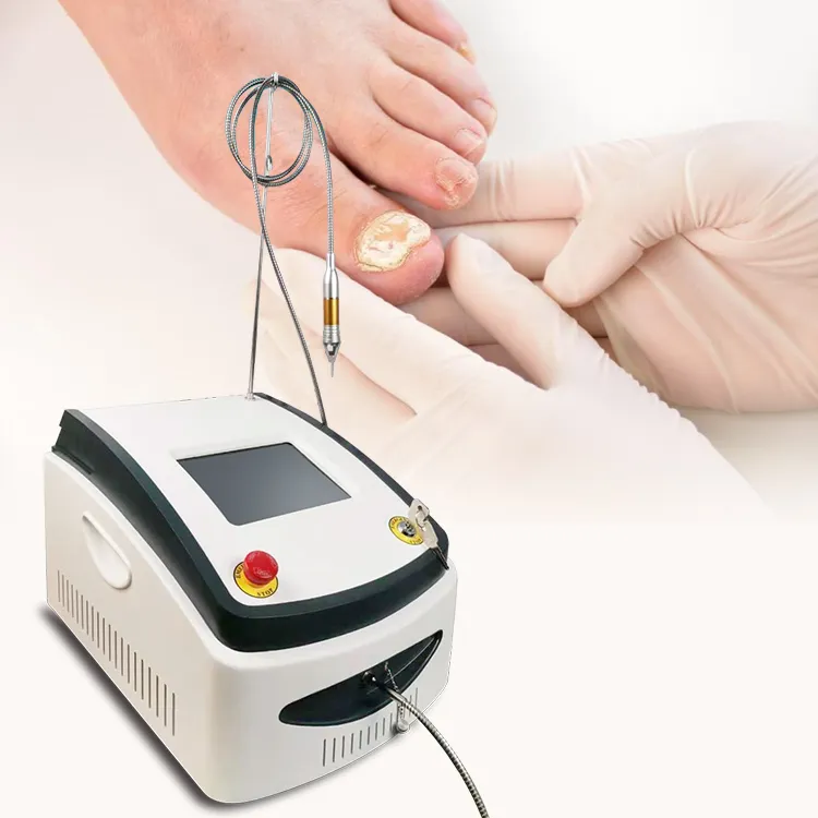 Laser Nail Fungus Treatment Demonstration 2