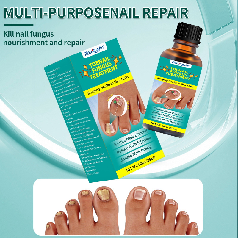 Herbal Extractions Toenail Fungus Treatment for Strengthening Weak Damaged Nails