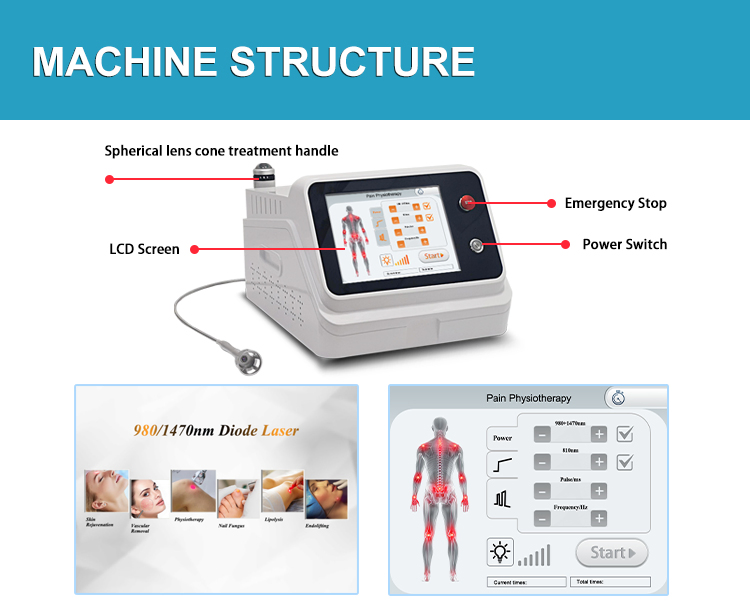 Portable Class 4 Hilt Physiotherapy Machine 980nm 810nm 1064nm Wavelengths Fisioterapia and Nail Fungus Treatment