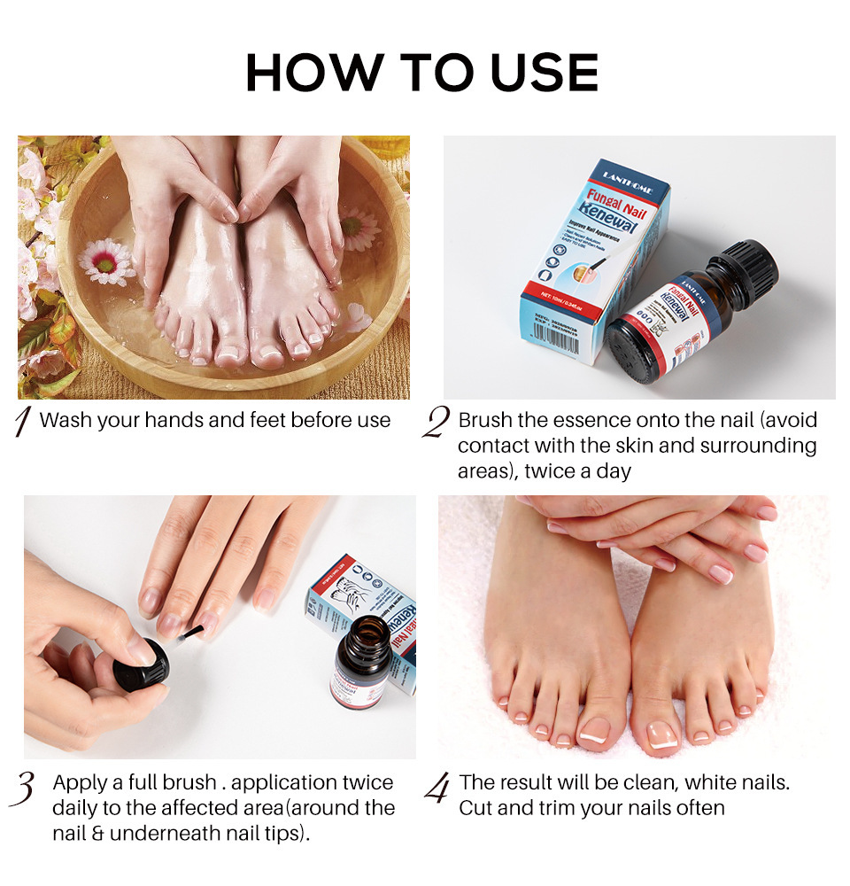 LANTHOME 10ml Nail Repair Solution Clean Whiten Nourish Nails Fungal Treatment Toe Nail Fungus Treatment