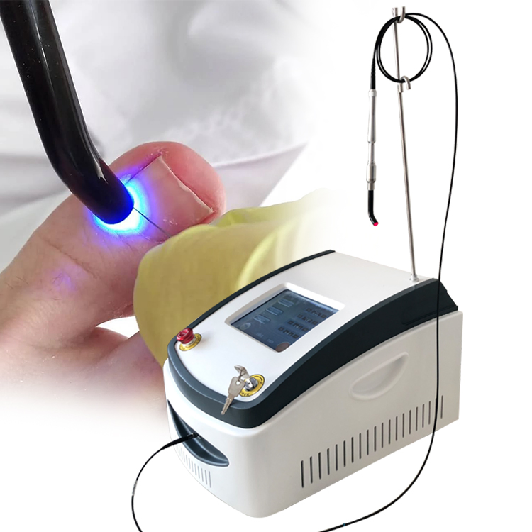 Hot Sale 2024 Nail Fungus Treatment Device 980nm Laser Fungus Treatment for Fungal Nail Onychomycosis Treatment