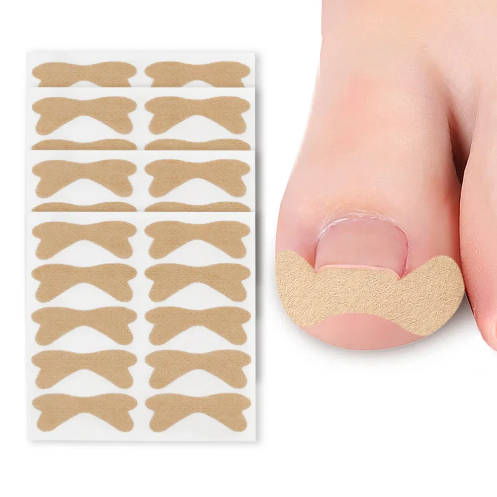 Pedicure Corrector Patch and Nail Correction Tool and Painless Corrector