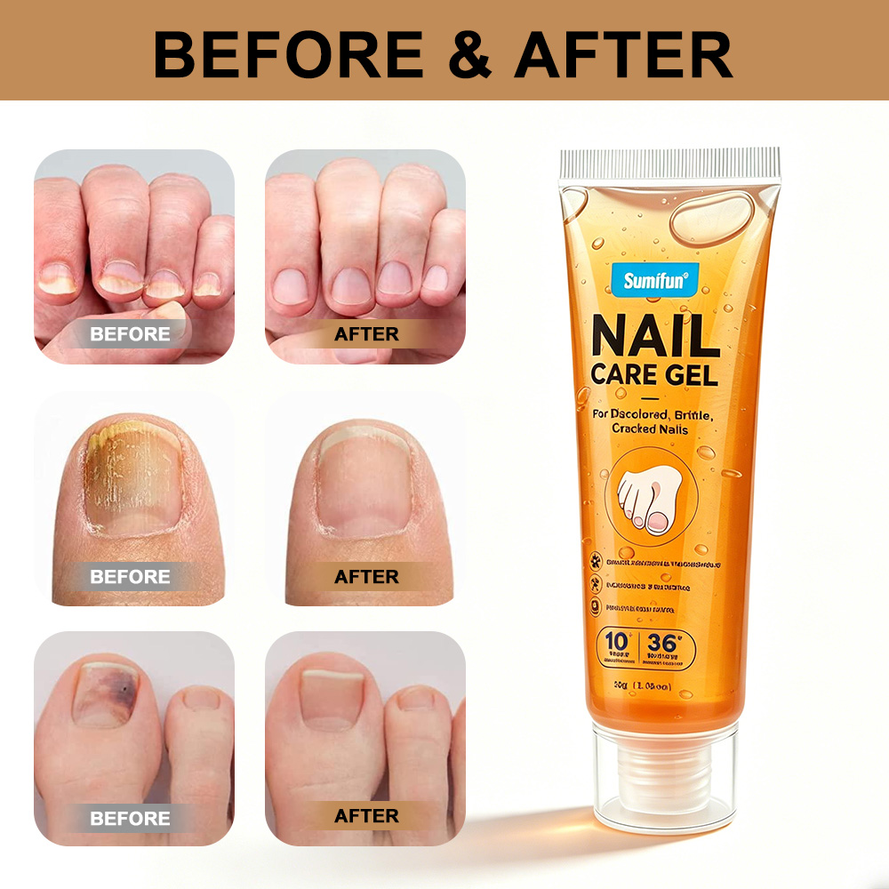 30g Sumifun Nail Repair Care Cream K910007