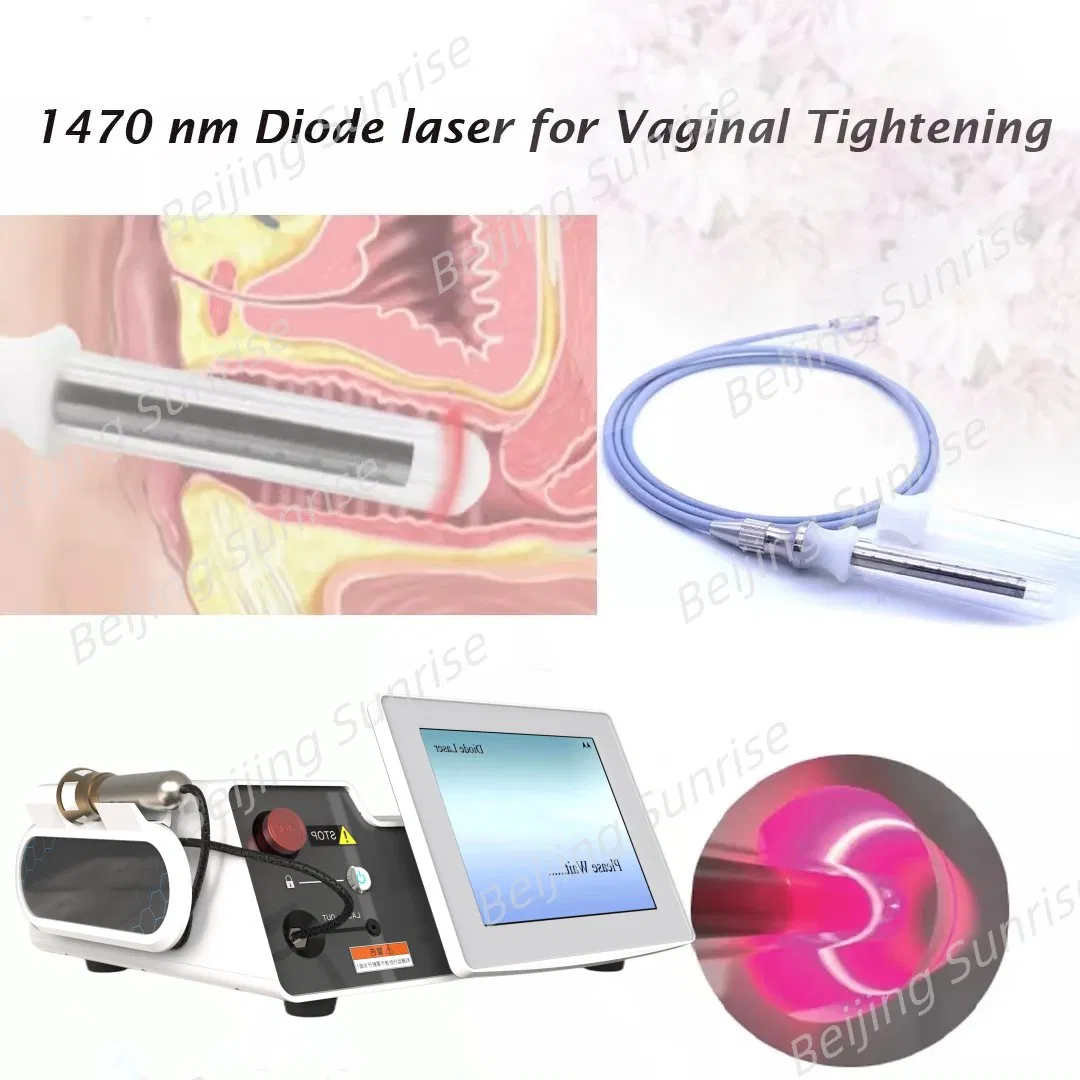Top Sale 980+1470nm Laser Vaginal Tightening Gynecology Product Tight Vagina Eliminate Vaginal Odor and Itching Vagina