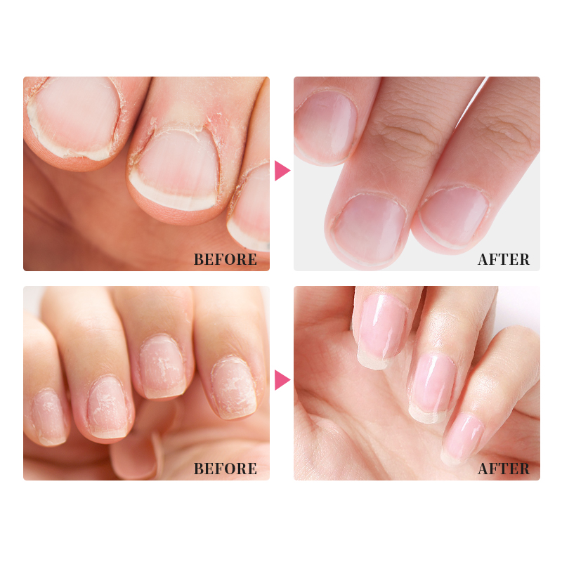 Nail Oil Cuticle Private Label Nail Flowers 3d Cuticle Custom logo Revitalizer Oil Nail Oil Cuticle Remover