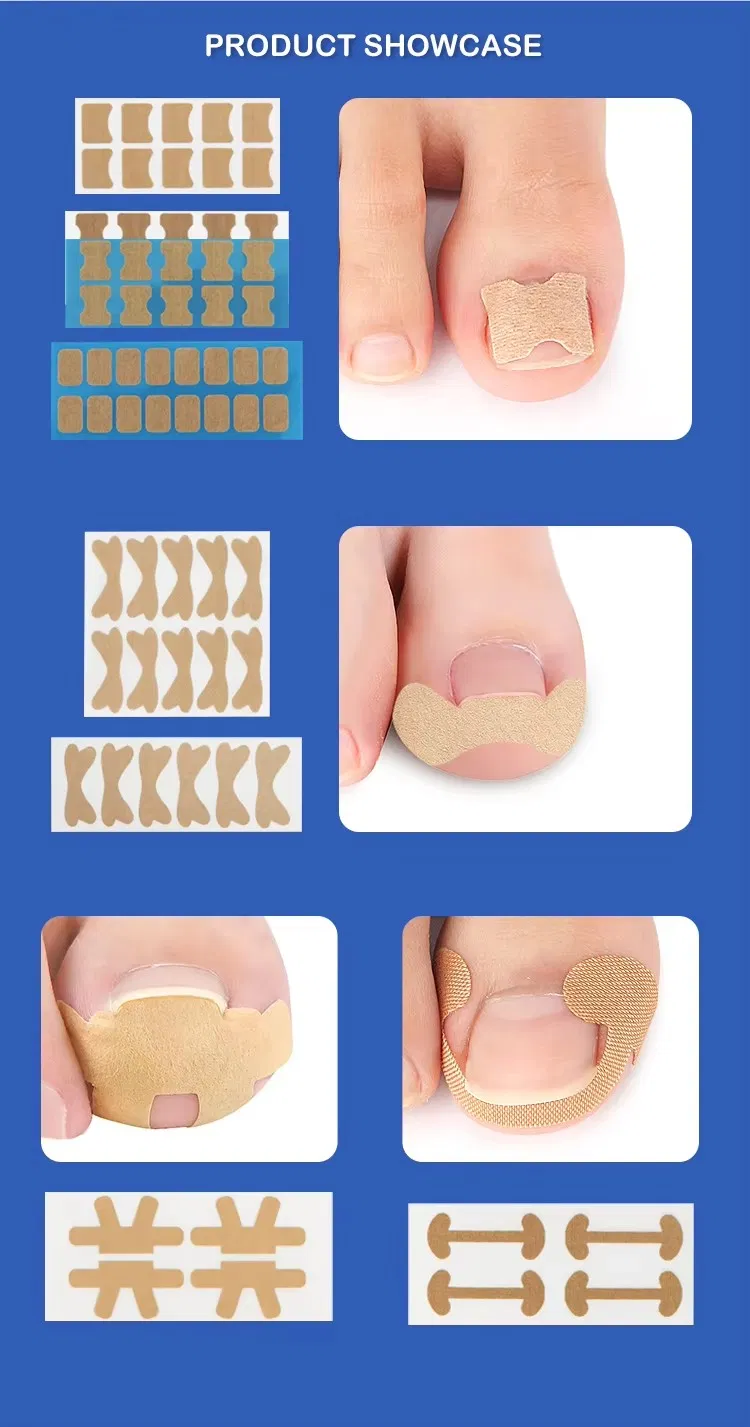 Pedicure Corrector Patch and Nail Correction Tool and Painless Corrector