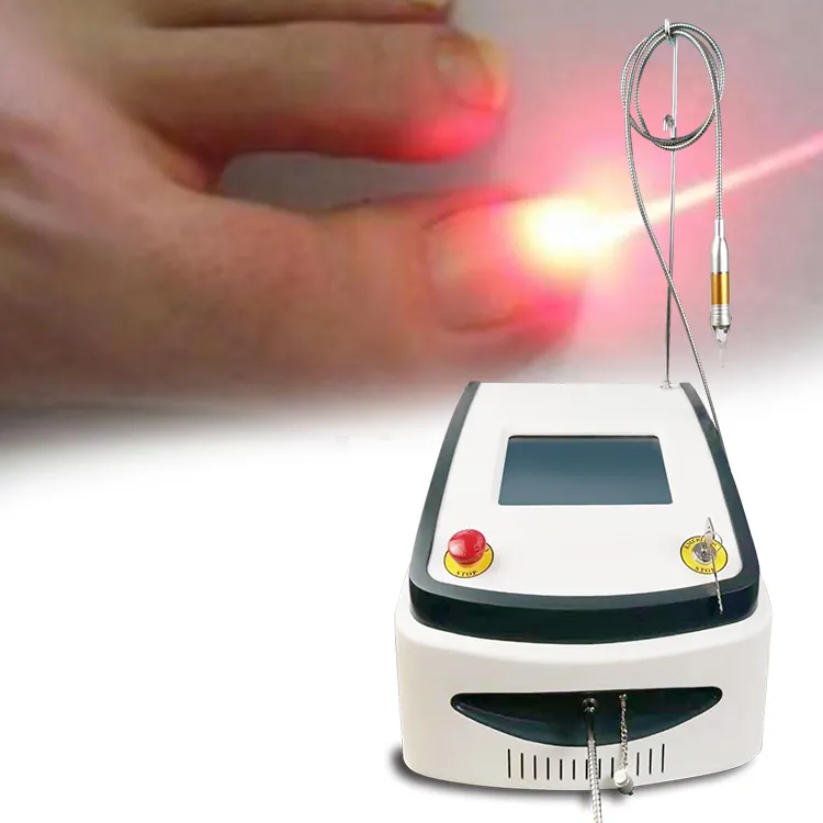 Laser Nail Fungus Treatment Demonstration 1