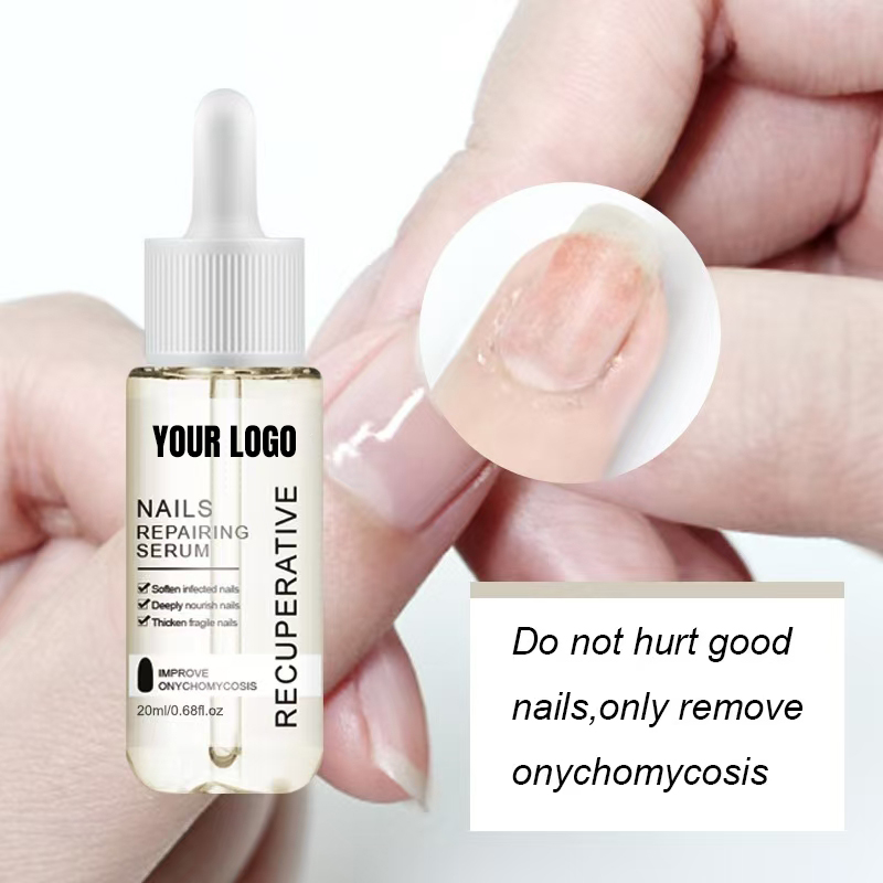 Gray Nail Polish Uneven Thick Spot Soft Repair Fluid Nail Serum for Repair Finger Edge Nail Polish Repair Fluid