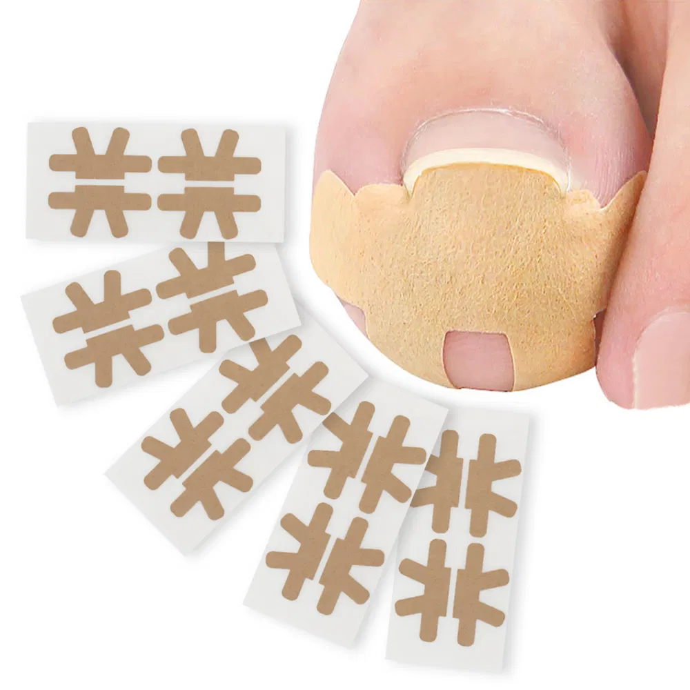 Pedicure Corrector Patch and Nail Correction Tool and Painless Corrector