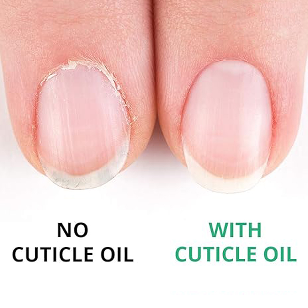 Salon Supplies Customized Logo Wholesale Nail Care Nourishing Formula 15ml Strawberry Rose Cuticle Oil Vitamin E Brush for Nails