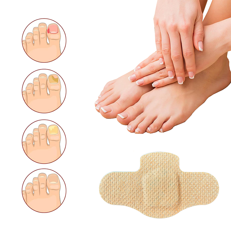 Nail Care Fungus Treatment Reduce Thickness Natural Herbal Anti Fungal Nail Treatment