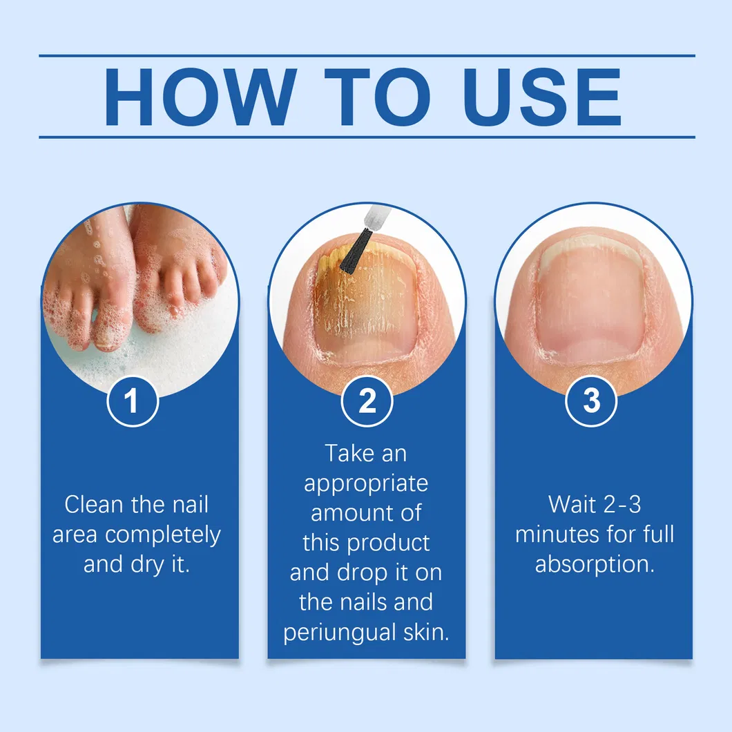 Nail Fungus Treatment View 6