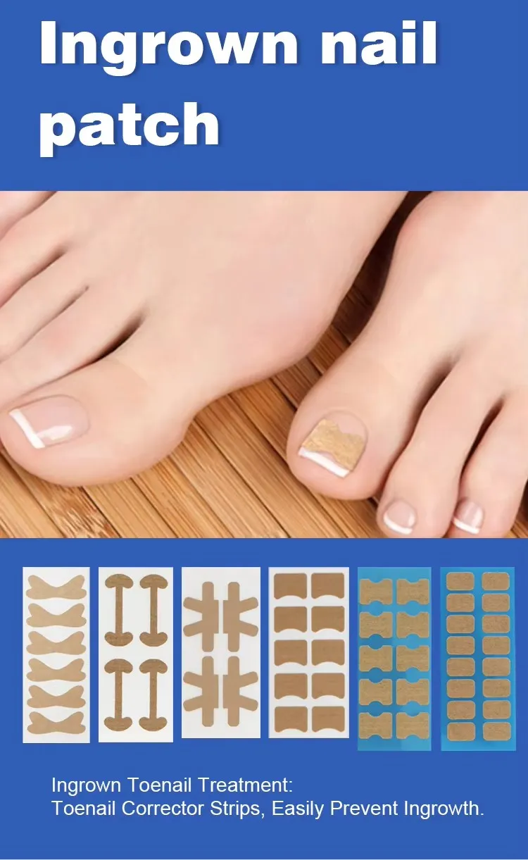 Pedicure Corrector Patch and Nail Correction Tool and Painless Corrector