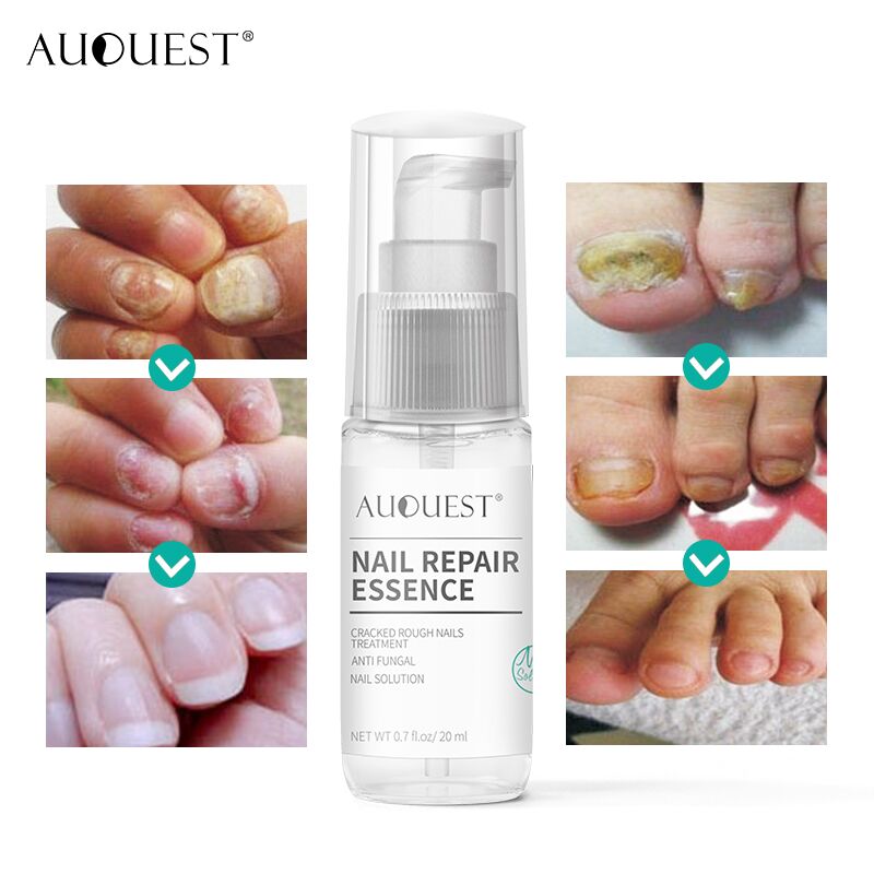 Wholesale New Arrival Nail Repair Spray Cracked Rough Dry Solution Speed Growth Stronger Nail Repair Serum