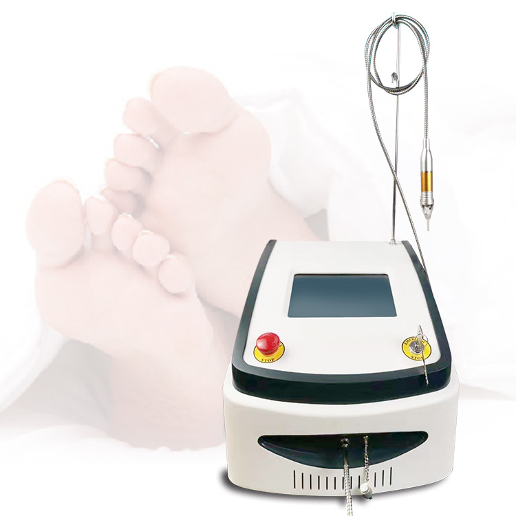 Hot Sale 2024 Nail Fungus Treatment Device 980nm Laser Fungus Treatment for Fungal Nail Onychomycosis Treatment