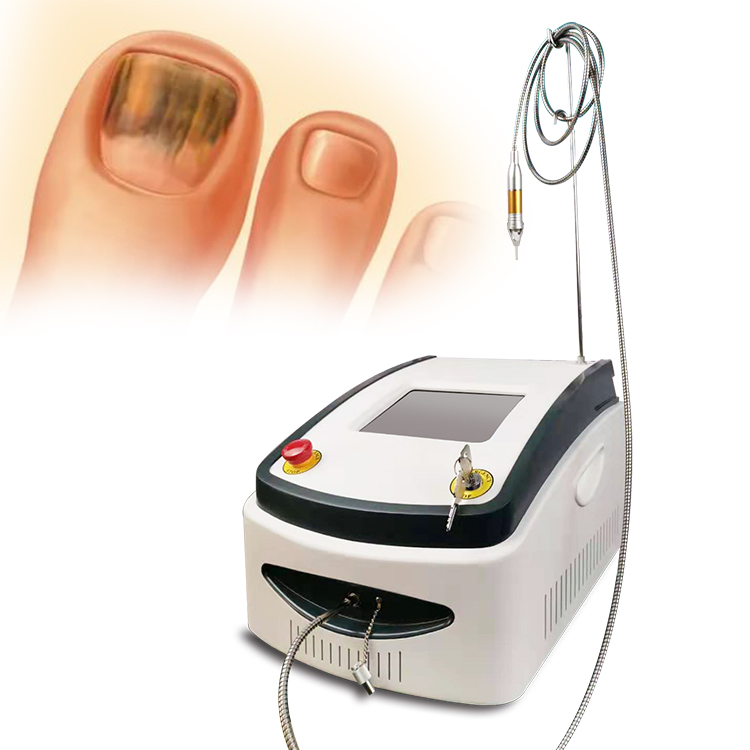 Best Sale 980nm Diode Laser Nails Fungus Treatment Physiotherapy Plantar Warts Removal