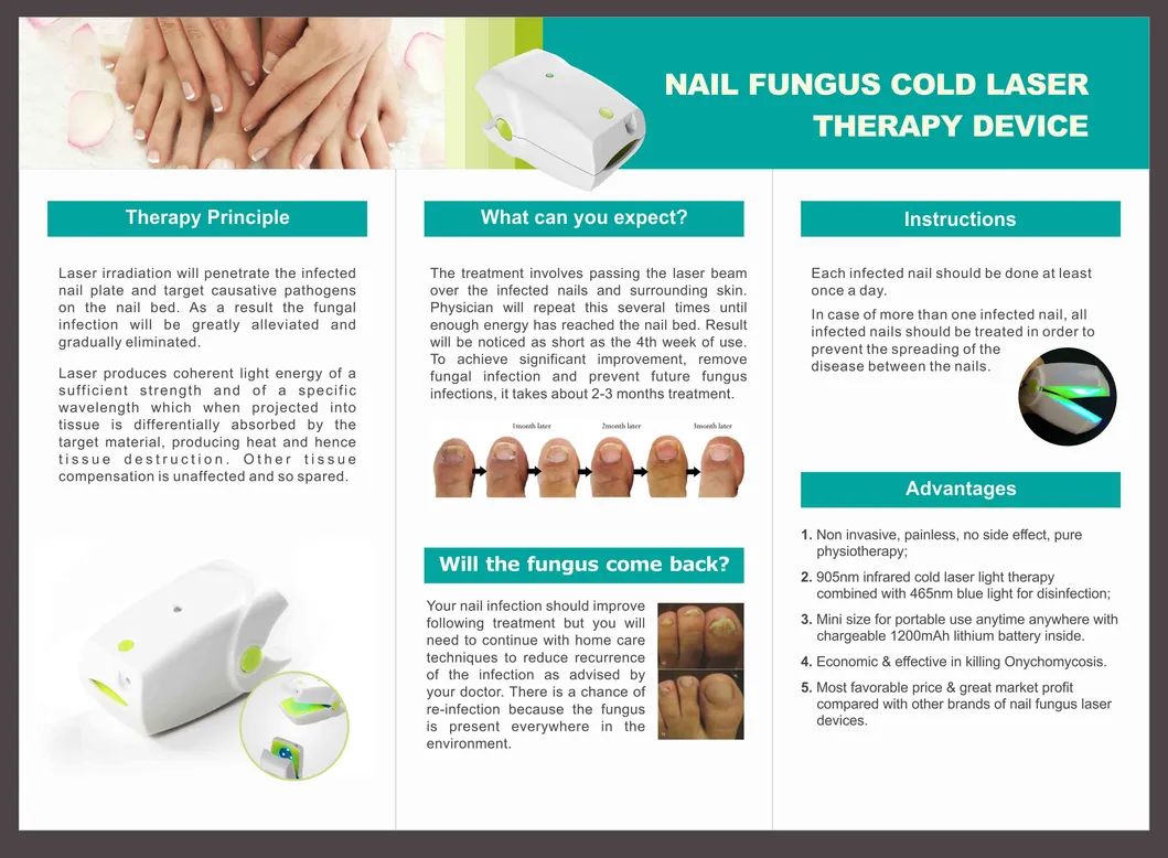 Nail Fungus Laser Therapy Treatment