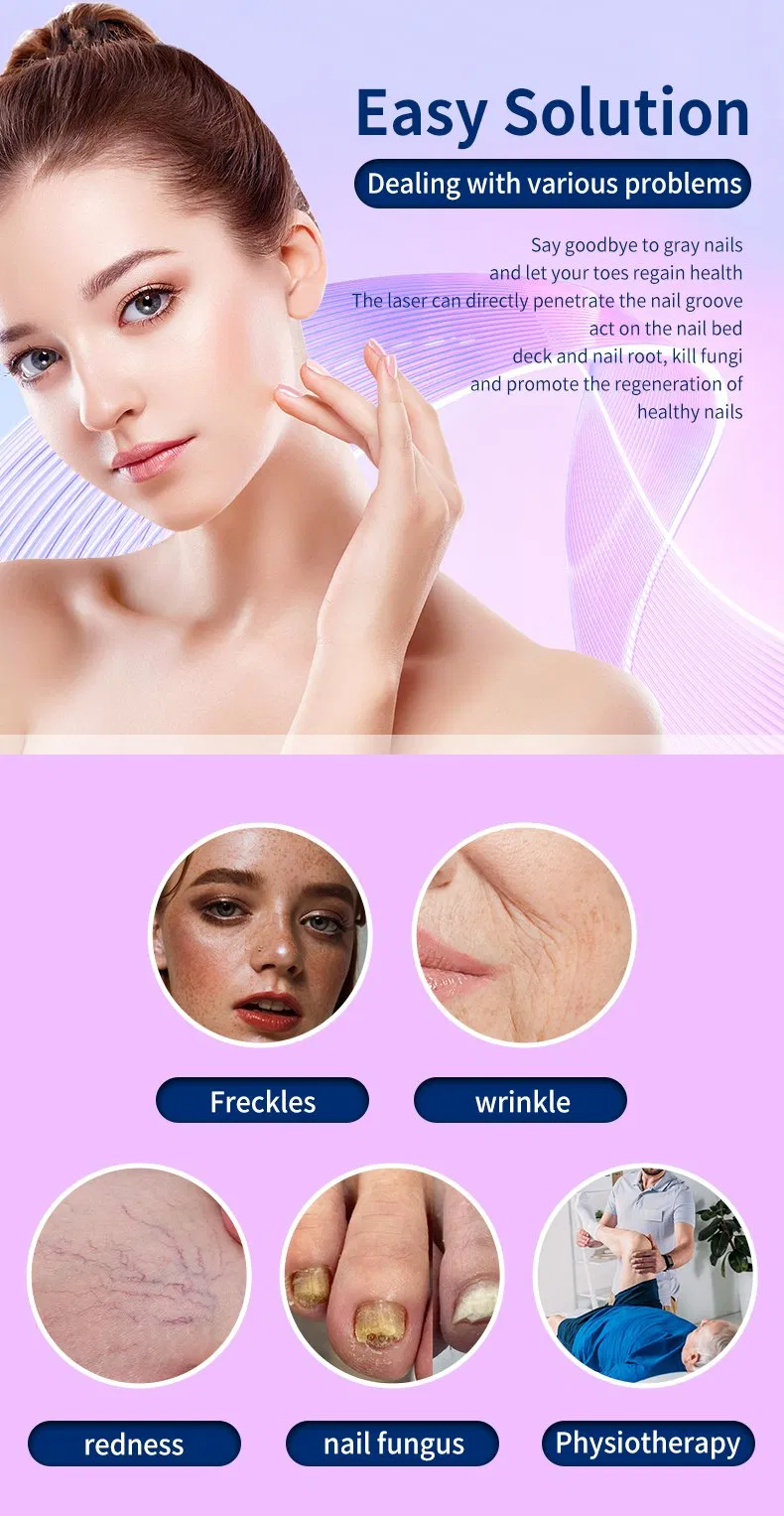 980nm Laser Vascular 980nm Diode Laser Treatment for Nail Fungus 980 for Vascular Resection 980nm Diode Laser Removal of Red Blood Vessels