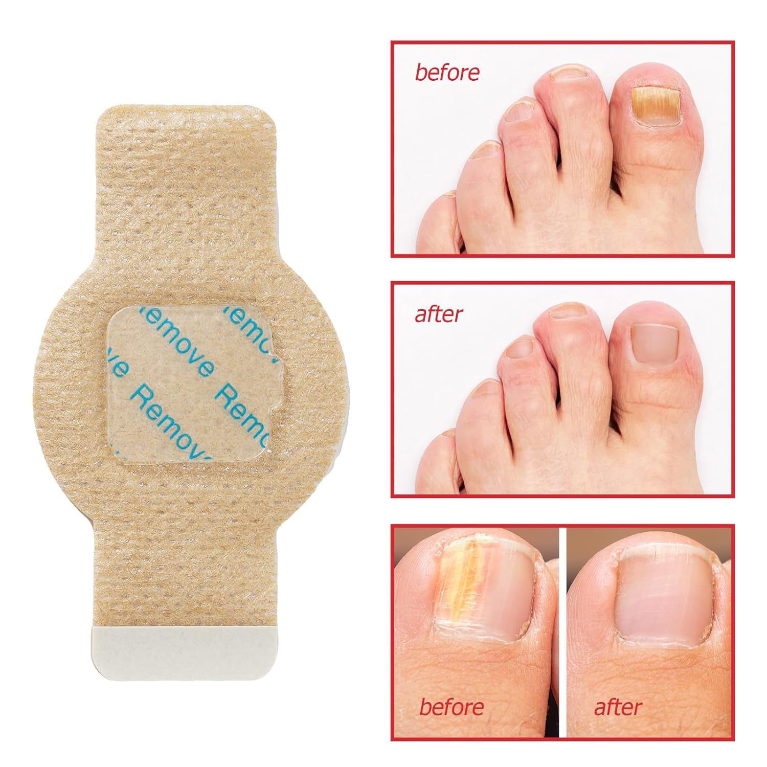 Damaged Discolored Fragile Nail Repair Solution Adhesive Nail Wraps and Stickers