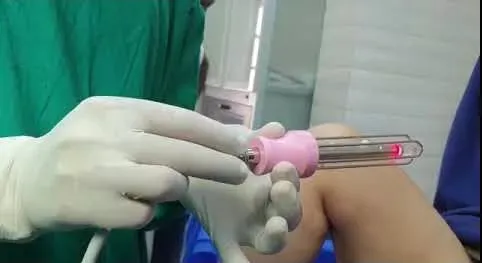 Role of Cosmetic Gynecology